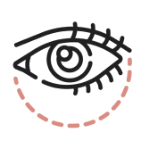 Eyebag Removal